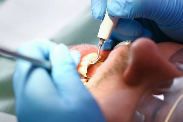 Best Broken or Cracked Tooth Emergency Dentist in High Ridge, MO
