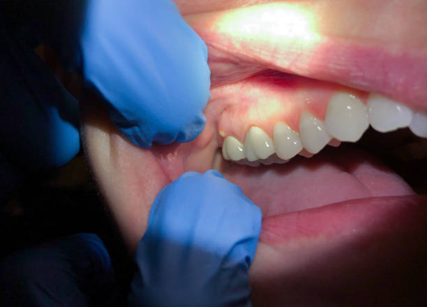Best Mobile Emergency Dentist in High Ridge, MO